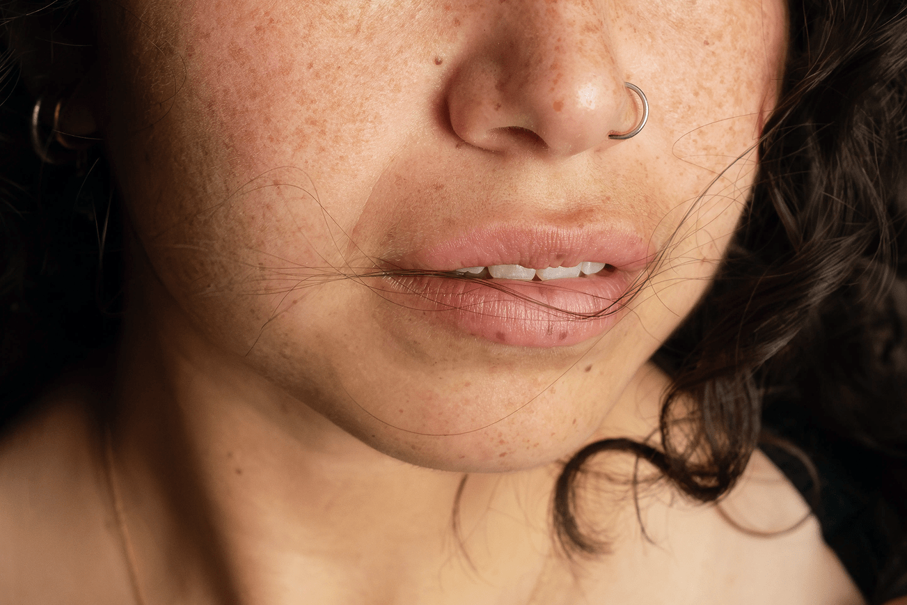 Tight & Bright solves six skin problems in one session!