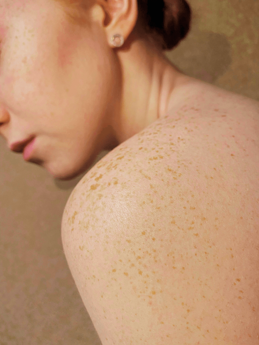 Preparation for treatment